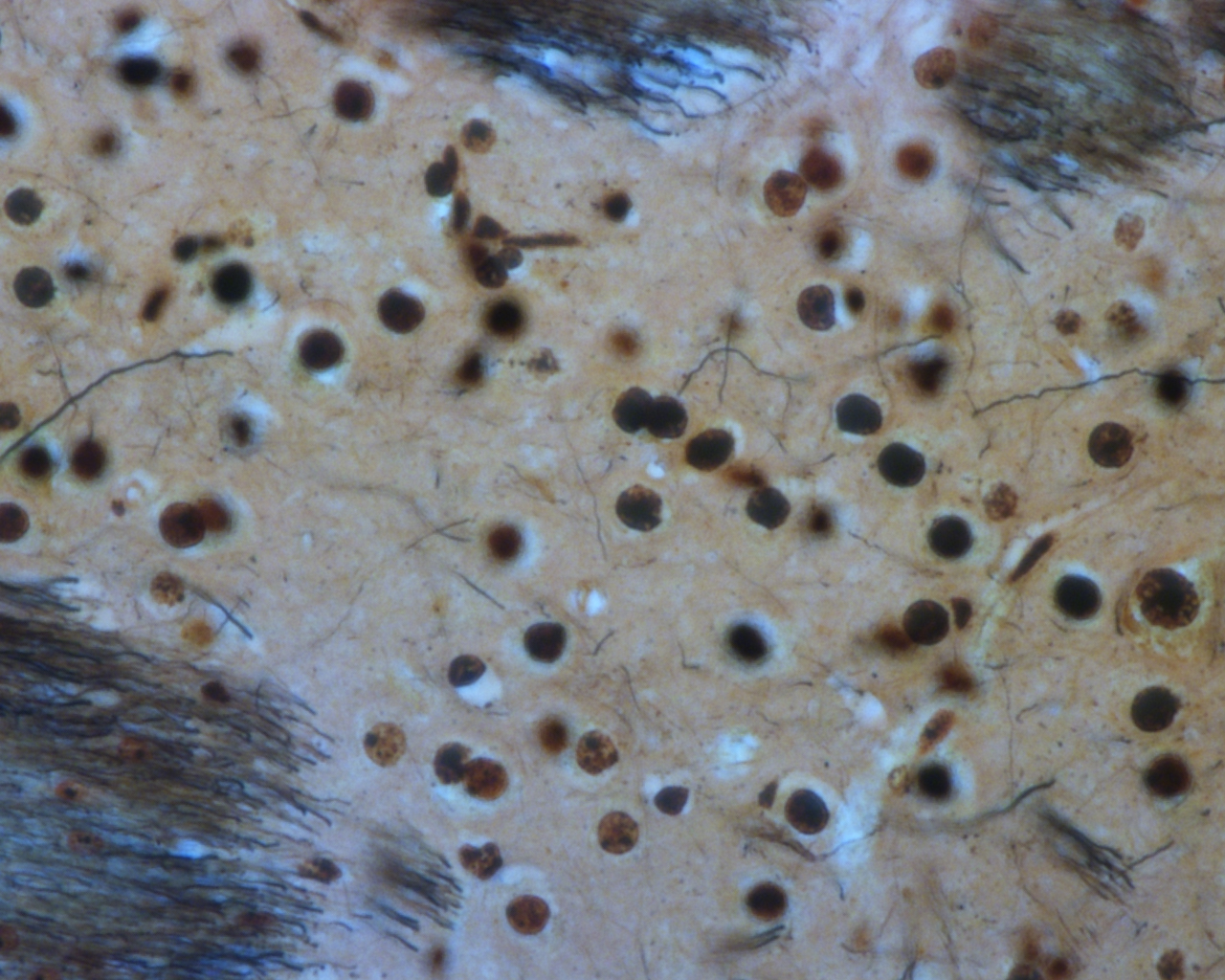 Brain - 224intact caudate putMEN 224-224 60X.jpg