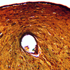 Brain - 409-333 MH detour.jpg