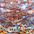 Brain - 77-214 sm z 40xopa 1t08 undulating neurons.jpg